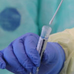 Sollten Antigentests kostenpflichtig werden?