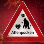 Pockengefahr – Die große Affentransformation